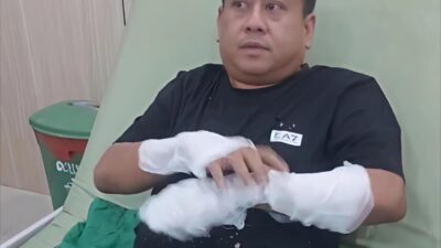 Aktivis Bangka Selatan Jadi Korban Teror Penyiraman Air Keras oleh OTK